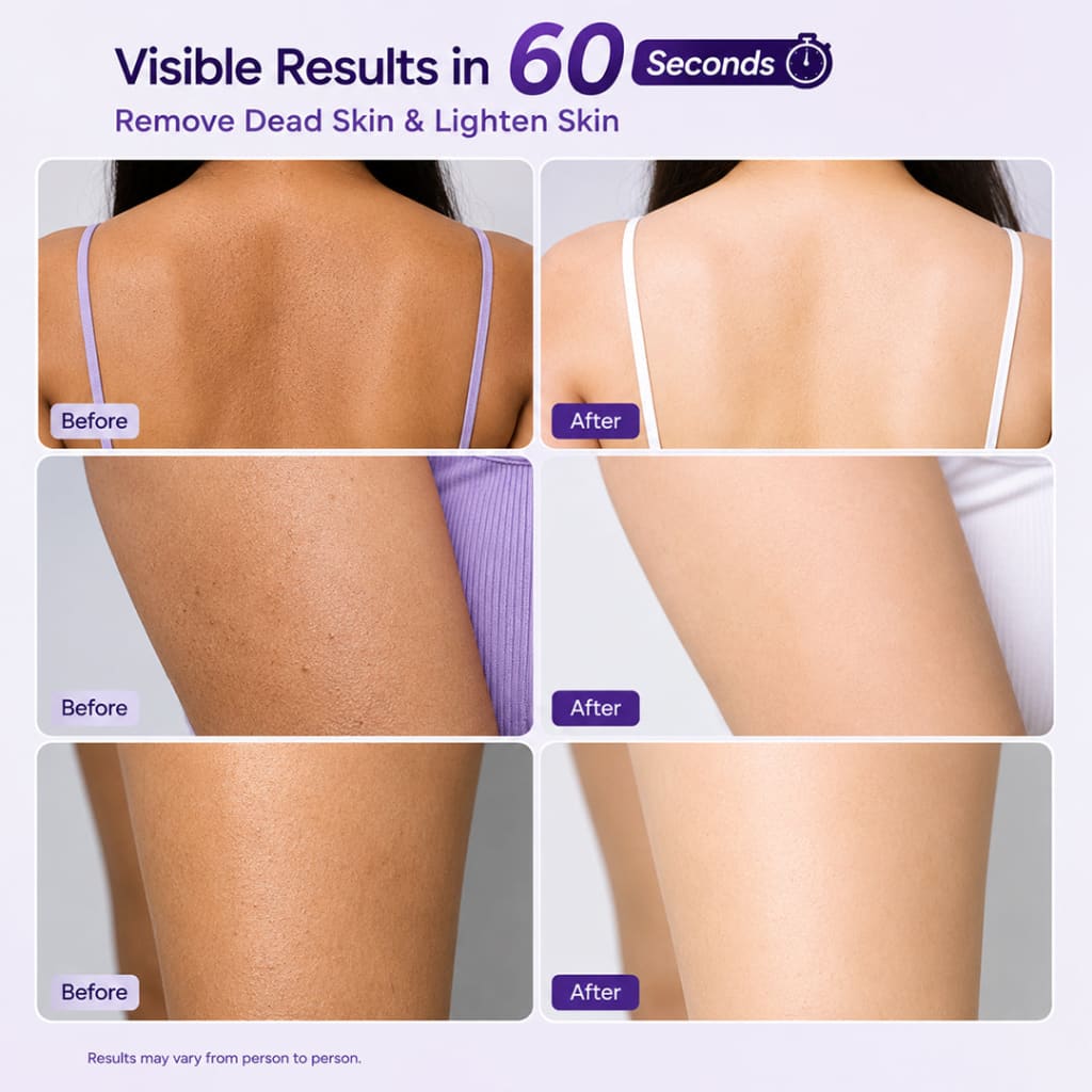 Sanfe Instant Tan & Dead Skin Removal Exfoliating Gel
